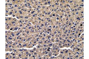ABIN7096708 and ABIN7100773 at 1/100 staining mouse liver tissue by IHC-P. (SERPINA7 Antikörper)