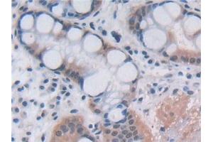Immunohistochemistry (IHC) image for anti-2'-5'-Oligoadenylate Synthetase 2, 69/71kDa (OAS2) (AA 11-346) antibody (ABIN7436105)