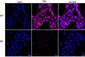 Immunocytochemical staining of HeLa cells using TFG antibody (ABIN7800647), 1:1,000), Top panel: wild-type (WT), Bottom panal: TFG shRNA knockdown (KD). (Rekombinanter TFG Antikörper)