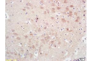 Formalin-fixed and paraffin embedded rat brain labeled with Rabbit Anti GPAM Polyclonal Antibody, Unconjugated (ABIN709121) at 1:200 followed by conjugation to the secondary antibody and DAB staining (GPAM Antikörper  (AA 611-710))