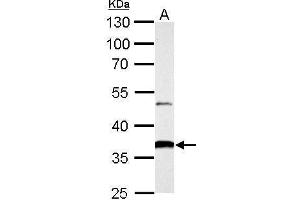 Western Blotting (WB) image for anti-Aldo-Keto Reductase Family 1, Member B10 (Aldose Reductase) (AKR1B10) antibody (ABIN2856687)