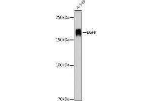 Western blot analysis of extracts of A-549 cells, using EGFR antibody (ABIN7266982) at 1:1000 dilution. (EGFR Antikörper  (AA 1021-1210))