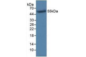 Figure. (TK1 Antikörper  (AA 2-234))
