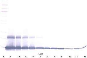 Image no. 3 for anti-Chemokine (C-C Motif) Ligand 9 (Ccl9) antibody (ABIN465416) (CCL9 Antikörper)