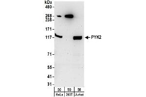Western Blotting (WB) image for anti-PTK2B Protein tyrosine Kinase 2 beta (PTK2B) (AA 959-1009) antibody (ABIN7450623)