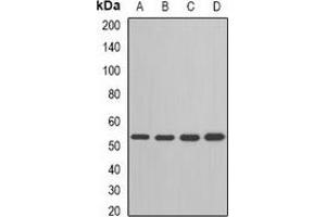 Western blot analysis of ADSL expression in HepG2 (A), Jurkat (B), mouse heart (C), rat brain (D) whole cell lysates.