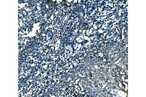 IHC analysis of MEF2B using anti-MEF2B antibody (ABIN7599892). (MEF2B Antikörper  (AA 127-352))