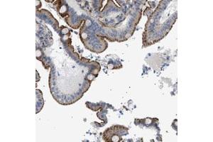Immunohistochemical staining (Formalin-fixed paraffin-embedded sections) of human duodenum with SFXN5 polyclonal antibody  shows cytoplasmic and membranous positivity in glandular cells at 1:50-1:200 dilution. (Sideroflexin 5 Antikörper)
