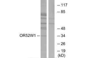 Western blot analysis of extracts from HeLa cells, using OR52W1 antibody. (OR52W1 Antikörper  (C-Term))