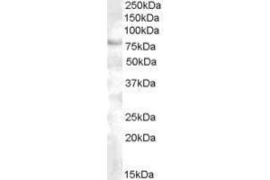 Western Blotting (WB) image for anti-Forkhead Box P2 (FOXP2) (C-Term) antibody (ABIN2473695) (FOXP2 Antikörper  (C-Term))