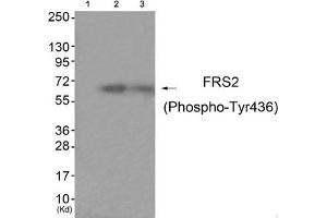 Western blot analysis of extracts from HuvEc cells (Lane 2) and JK cells (Lane 3), using FRS2 (Phospho-Tyr436) Antibody. (FRS2 Antikörper  (pTyr436))