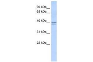 Image no. 1 for anti-Ribonucleotide Reductase M2 (RRM2) (AA 35-84) antibody (ABIN6740949) (RRM2 Antikörper  (AA 35-84))