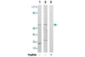Western blot analysis of extracts from LoVo cells (Lane 1 and lane 3) and HUVEC cells (Lane 2), using CYP39A1 polyclonal antibody .