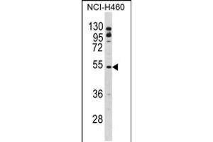 Western blot analysis of BLNK Antibody in NCI-H460 cell line lysates (35ug/lane) (B-Cell Linker Antikörper  (AA 150-178))