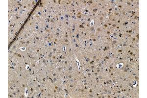 ABIN7095526 and ABIN7099583 at 1/100 staining rat brain tissue by IHC-P.