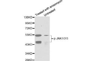 Western blot analysis of extracts from C6 cells untreated or treated with anisomycin using Phospho-MAPK8/9/10-T183/Y185 Antibody. (MAPK8/9/10 Antikörper  (pThr221, pTyr223))
