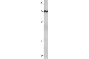 Western Blotting (WB) image for anti-Insulin-Like Growth Factor 2 mRNA Binding Protein 1 (IGF2BP1) antibody (ABIN2431370) (IGF2BP1 Antikörper)