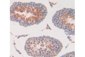 Used in DAB staining on fromalin fixed paraffin- embedded Kidney tissue (CBR1 Antikörper  (AA 2-271))