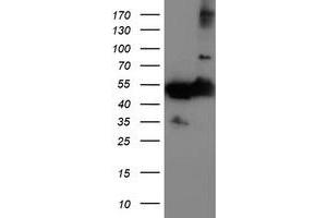 Western Blotting (WB) image for anti-Tubulin, alpha-Like 3 (TUBAL3) (AA 150-446) antibody (ABIN1490957) (TUBAL3 Antikörper  (AA 150-446))