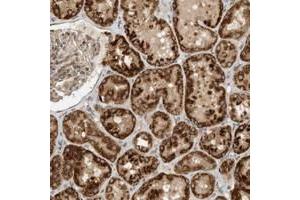 Immunohistochemical staining of human kidney with CPAMD8 polyclonal antibody  shows strong cytoplasmic positivity in cells of tubules at 1:10-1:20 dilution.