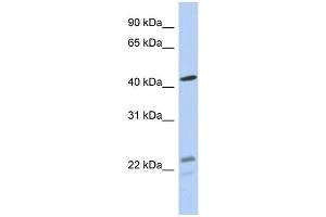 WB Suggested Anti-BCKDHA Antibody Titration: 0. (BCKDHA Antikörper  (N-Term))