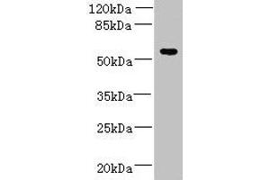 Western blot All lanes: ADAT1 antibody at 6 μg/mL + MDA-MB-231 whole cell lysate Secondary Goat polyclonal to rabbit IgG at 1/10000 dilution Predicted band size: 56, 39 kDa Observed band size: 56 kDa (ADAT1 Antikörper  (AA 1-501))