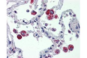 IHC Information: Lung, Human: Formalin-Fixed, Paraffin-Embedded (FFPE) (CYBB Antikörper  (C-Term))