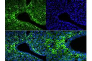 Formalin-fixed and paraffin embedded mouse fetal liver labeled with Rabbit Anti-Talin Polyclonal Antibody, FITC Conjugated at 1:200 for 60 minutes. (TLN1 Antikörper  (AA 1601-1750) (FITC))