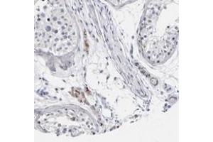 Immunohistochemical staining of human testis with CATSPERD polyclonal antibody  shows moderate cytoplasmic positivity in Leydig cells at 1:50-1:200 dilution.
