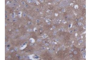 DAB staining on IHC-P; Samples: Mouse Cerebrum Tissue (SYN2 Antikörper  (AA 88-422))