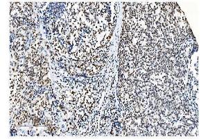 IHC analysis of NRF1 using anti-NRF1 antibody (ABIN7600874). (NRF1 Antikörper  (AA 246-503))