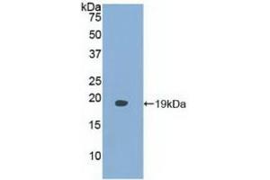 Detection of Recombinant FABP9, Human using Polyclonal Antibody to Fatty Acid Binding Protein 9, Testis (FABP9) (FABP9 Antikörper  (AA 1-132))