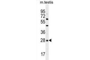 Western Blotting (WB) image for anti-C-Type Lectin Domain Family 12, Member B (CLEC12B) antibody (ABIN2996273) (CLEC12B Antikörper)