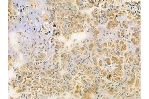 anti-Serine/threonine-Protein Kinase PRKY (PRKY) (C-Term) antibody
