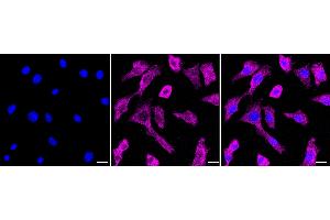 anti-DnaJ (Hsp40) Homolog, Subfamily A, Member 4 (DNAJA4) antibody