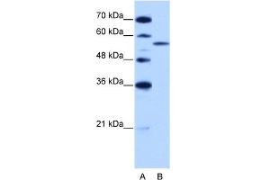 WB Suggested Anti-ZRSR2 Antibody Titration:  2. (ZRSR2 Antikörper  (C-Term))