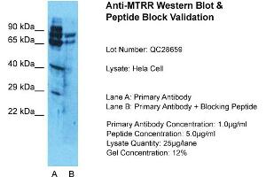 Host: Rabbit  Target Name: MTRR  Sample Tissue: HelaLane A:  Primary Antibody Lane B:  Primary Antibody + Blocking Peptide Primary Antibody Concentration: 1 µg/mL Peptide Concentration: 5. (MTRR Antikörper  (N-Term))