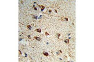 Formalin-fixed and paraffin-embedded human brain tissue reacted with Fibromodulin Antibody (C-term) followed which was peroxidase-conjugated to the secondary antibody, followed by DAB staining. (Fibromodulin Antikörper  (C-Term))