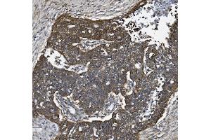 IHC analysis of ALK-1/ACVRL1 using anti-ALK-1/ACVRL1 antibody (ABIN7601037).