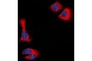 Immunofluorescent analysis of STMN1 staining in Hela cells. (Stathmin 1 Antikörper  (N-Term))