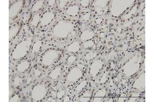 Immunoperoxidase of monoclonal antibody to SGK on formalin-fixed paraffin-embedded human kidney.