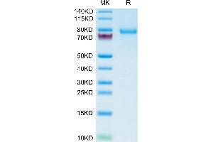 Human DSG-2 on Tris-Bis PAGE under reduced condition. (Desmoglein 2 Protein (DSG2) (AA 50-609) (His tag))