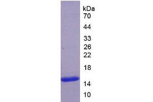 SDS-PAGE analysis of Human ADAMTS7 Protein. (ADAMTS7 Protein)