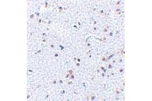 Immunohistochemistry of TSLP in human brain tissue with TSLP polyclonal antibody  at 2. (Thymic Stromal Lymphopoietin Antikörper  (C-Term))