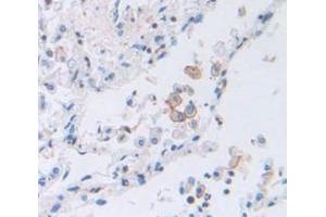 IHC-P analysis of Human Tissue, with DAB staining. (PTGER2 Antikörper  (AA 155-355))