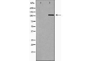 Western blot analysis of Hela whole cell lysates, using OGT Antibody. (OGT Antikörper  (N-Term))