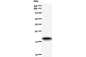 Western Blotting (WB) image for anti-Twist Homolog 1 (Drosophila) (TWIST1) antibody (ABIN933111) (TWIST1 Antikörper)