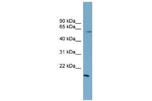WB Suggested Anti-ZNF83 Antibody Titration:  0. (ZNF83 Antikörper  (N-Term))