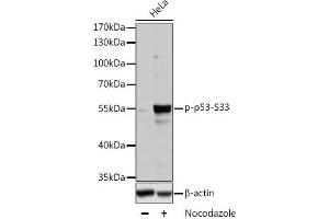 Western blot analysis of extracts of HT-29 cells using Phospho-p53(S33) Polyclonal Antibody at dilution of 1:2000. (p53 Antikörper  (pSer33))