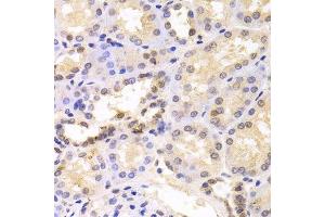 Immunohistochemistry (Paraffin-embedded Sections) (IHC (p)) image for anti-Proteasome (Prosome, Macropain) 26S Subunit, ATPase, 6 (PSMC6) (AA 20-150) antibody (ABIN6146328)